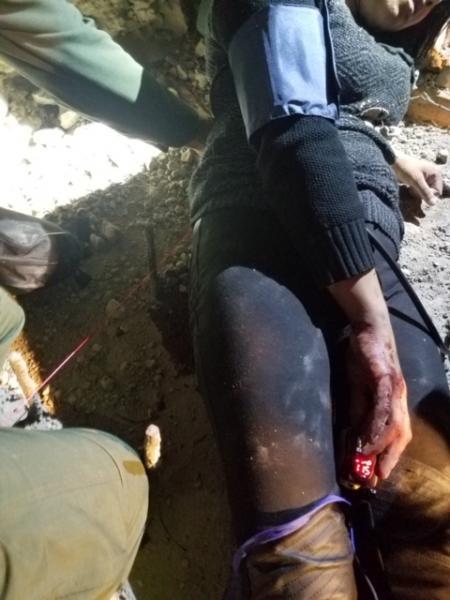Woman impaled on rebar after attempting to climb U.S. border wall (U.S. CBP)