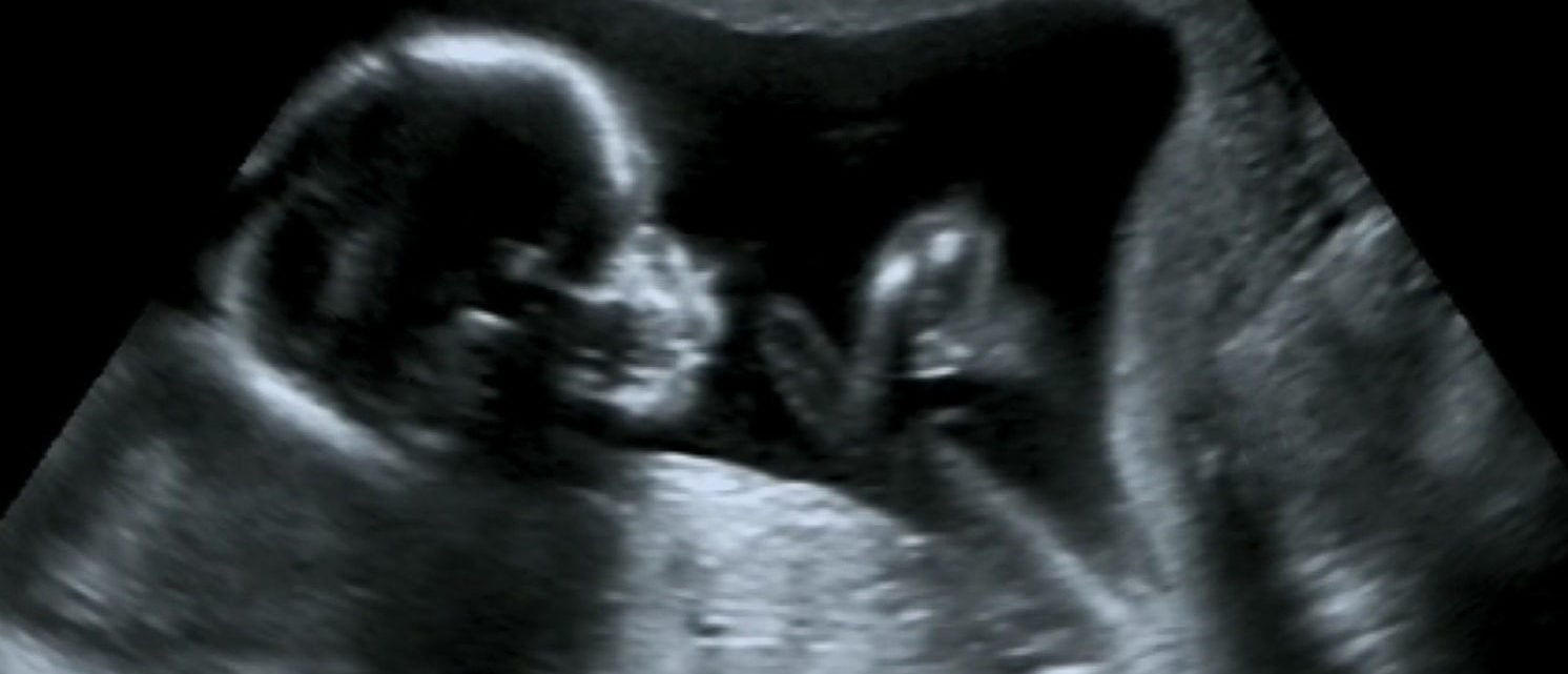 Ultrasound of baby in the womb/ Shutterstock