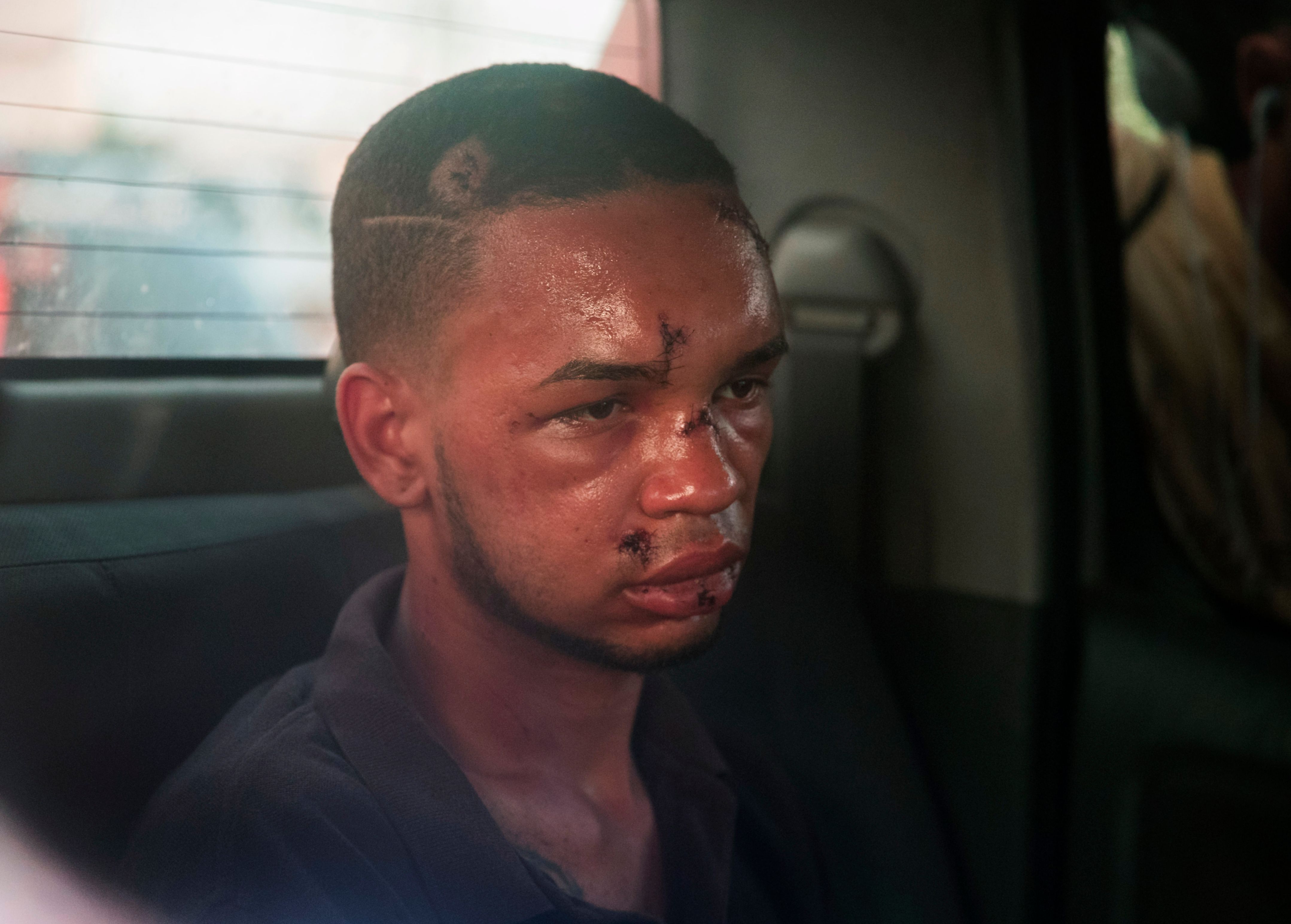 Eddy Vladimir Feliz Garcia, in custody in connection with the shooting of former Boston Red Sox slugger David Ortiz, is transferred by police to court in Santo Domingo, Dominican Republic, on June 11, 2019. (ERIKA SANTELICES/AFP/Getty Images)