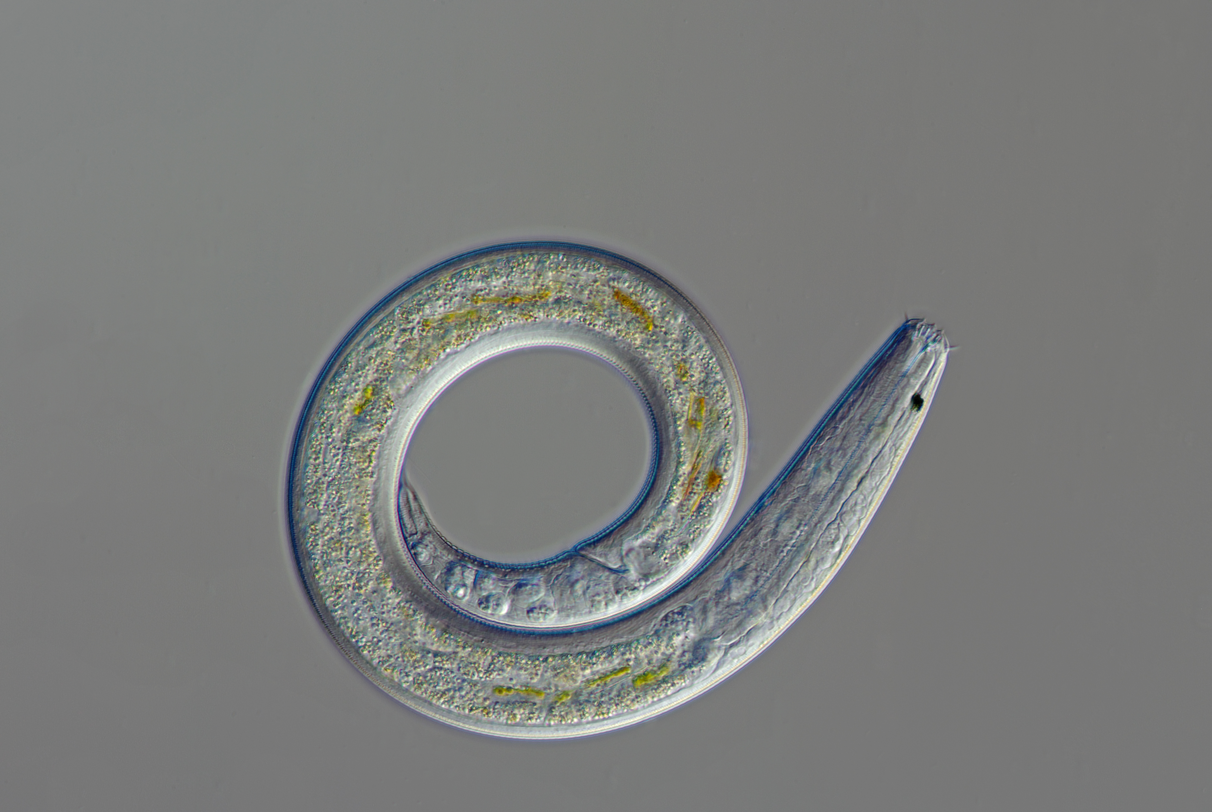 A nematode worm like the one Vishnivetskaya discovered and thawed. F.Neidl.