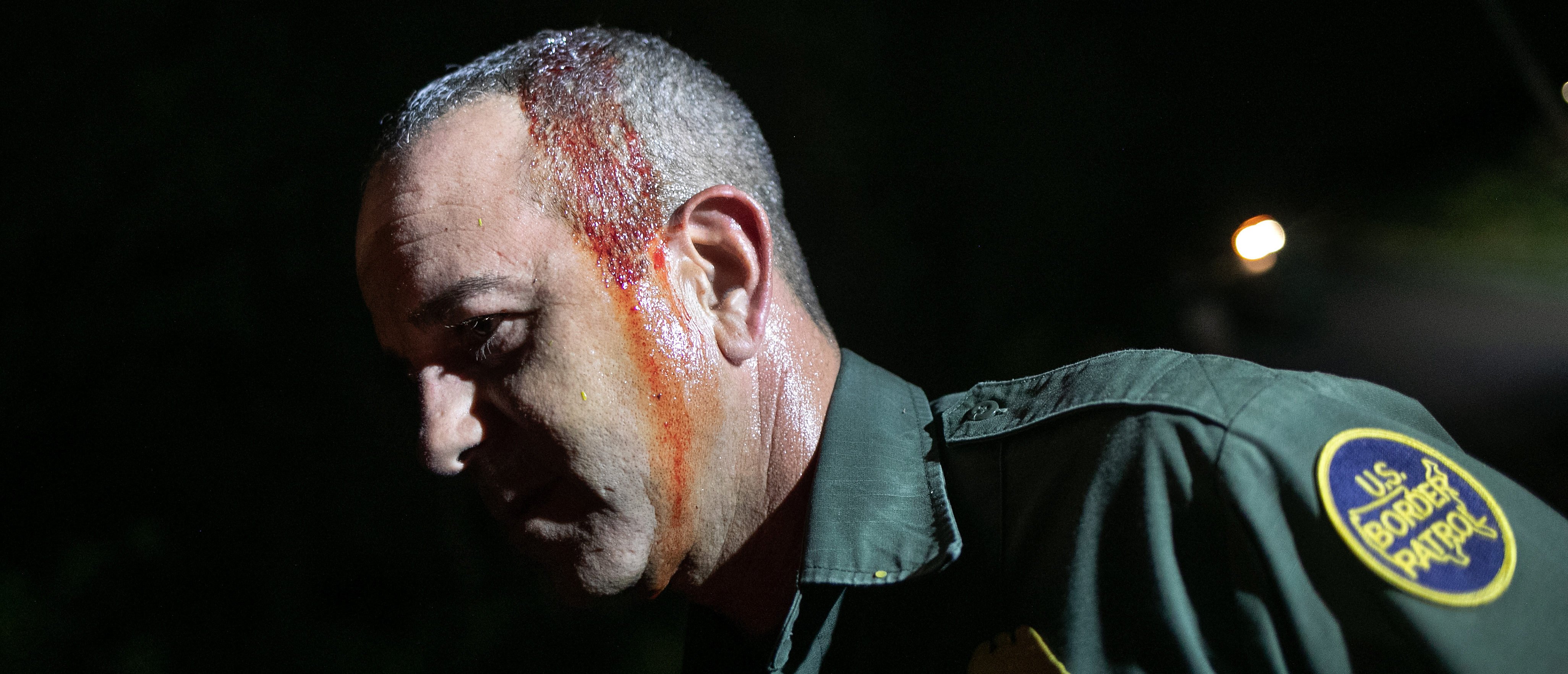 MISSION, TEXAS - SEPTEMBER 10: U.S. Border Patrol agent Carlos Ruiz bleeds from a light head wound after chasing undocumented immigrants through the woods on September 10, 2019 in Mission, Texas. Ruiz said he was hit by a branch while he was pursuing a group that had crossed the Rio Grande from Mexico into Texas earlier in the day. (Photo by John Moore/Getty Images)