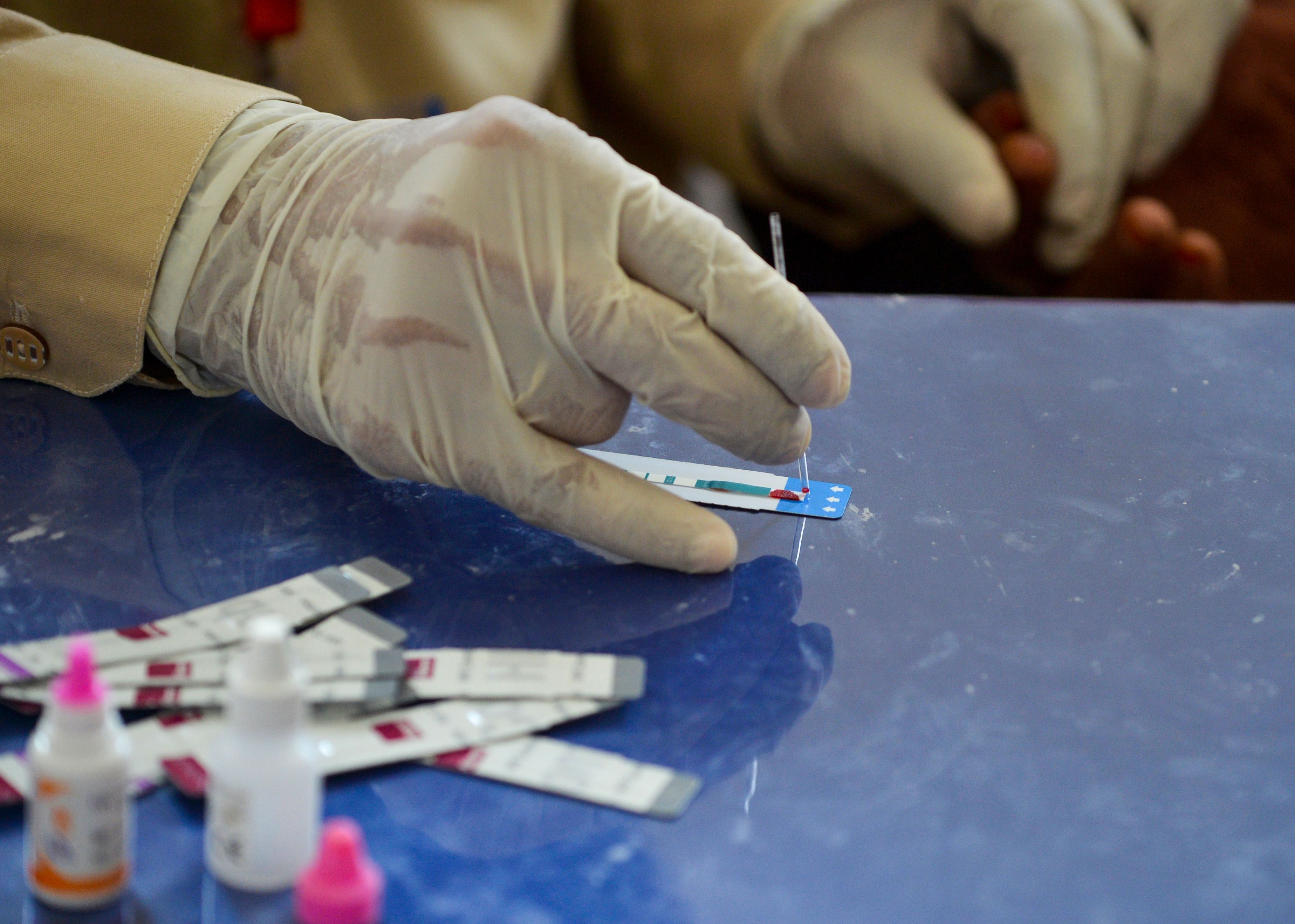 In this image taken on May 8, 2019, a Pakistani doctor examines the blood sample from a woman for a HIV test at a state-run hospital in Rato Dero in the district of Larkana of the southern Sindh province. (Photo credit should read RIZWAN TABASSUM/AFP/Getty Images)