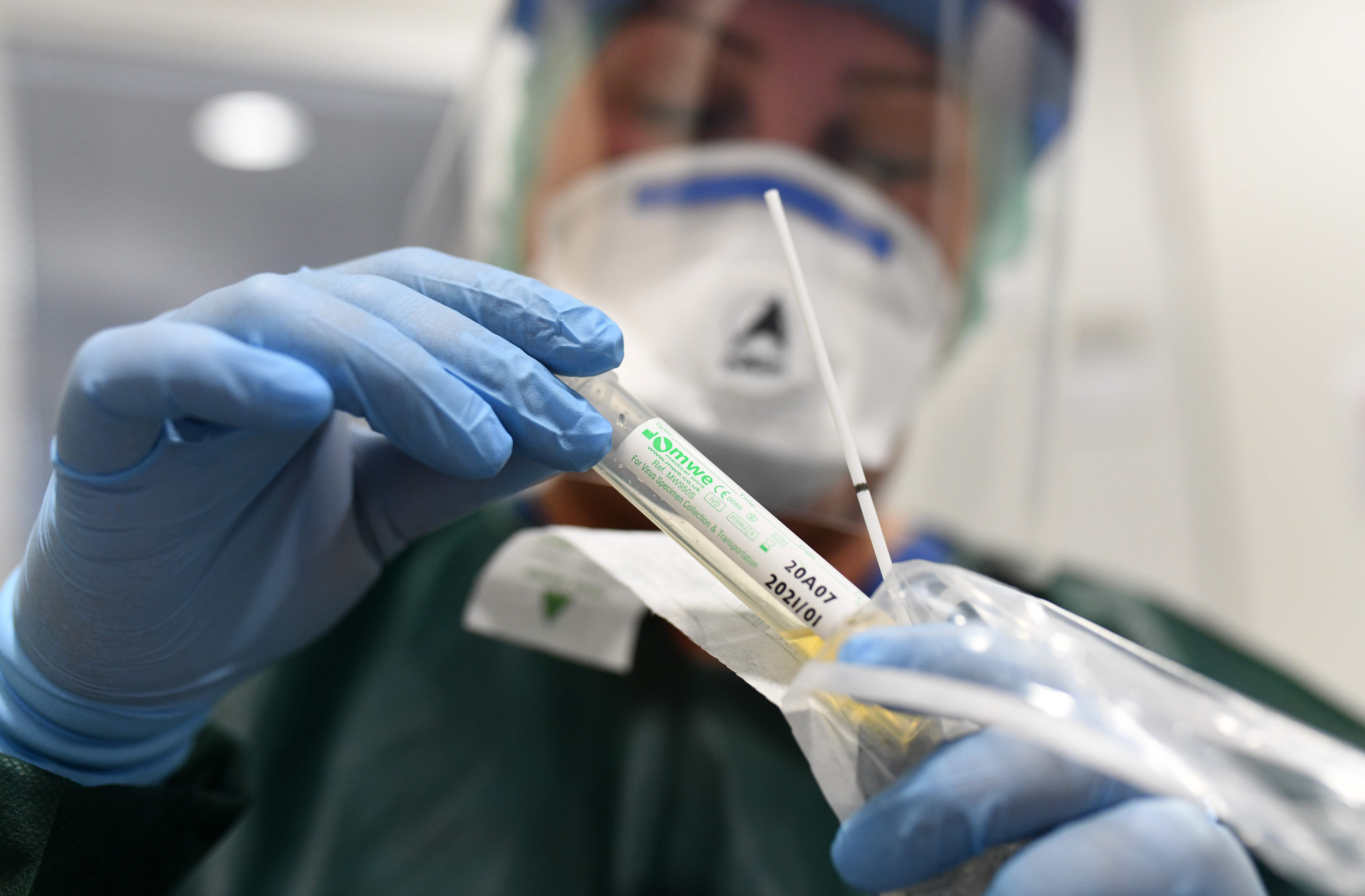 Nurse Canan Emcan shows a test kit for coronavirus samples at the isolation ward of the Uniklinikum Essen university hospital in Essen, western Germany. (Photo by INA FASSBENDER/AFP via Getty Images)
