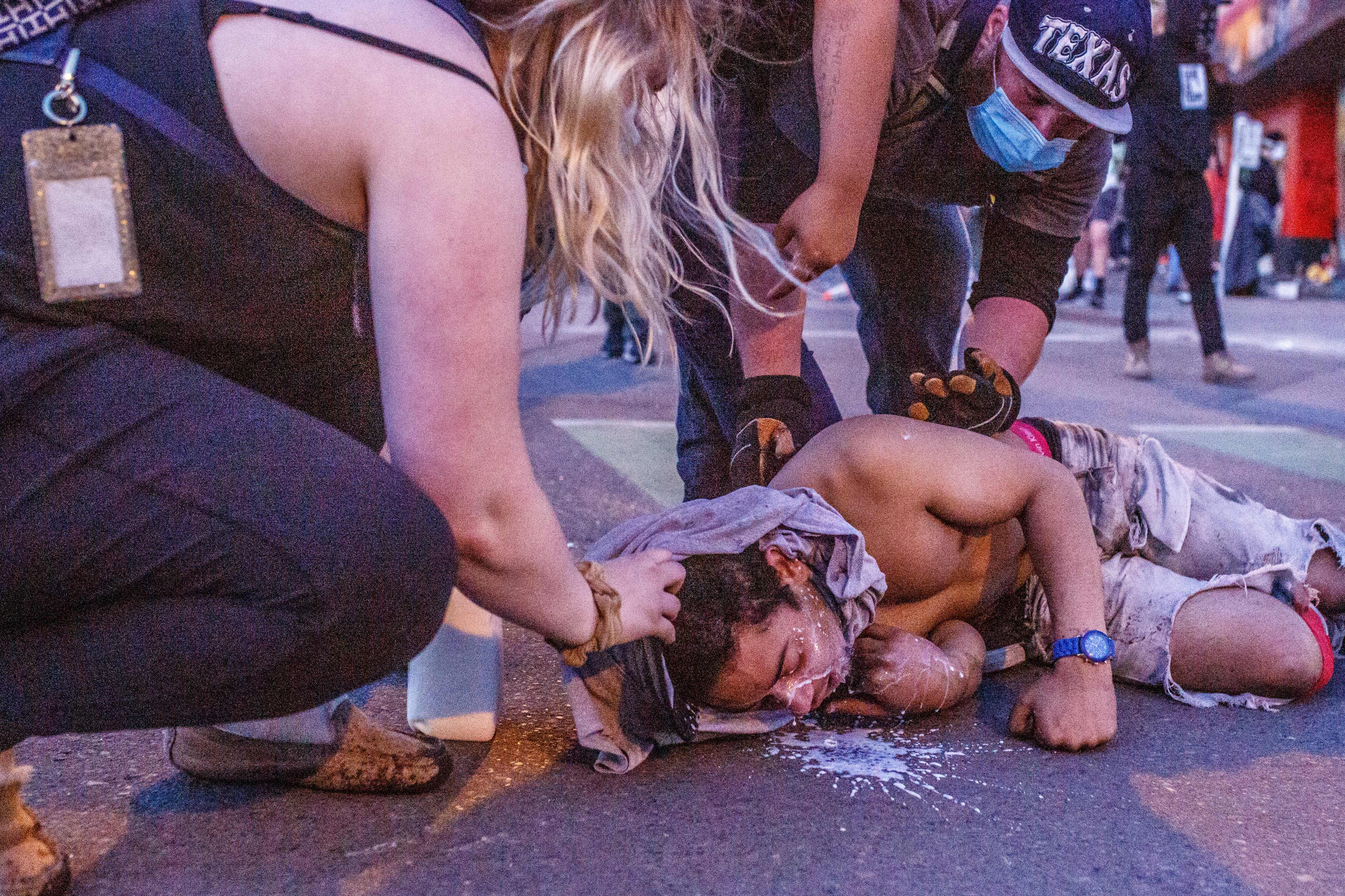 People assist an injured man during a protest outside the Third Police Precinct on May 28, 2020 in Minneapolis, Minnesota, over the death of George Floyd, an unarmed black man, who died after a police officer kneeled on his neck for several minutes. - Authorities in Minneapolis and its sister city St. Paul got reinforcements from the National Guard on May 28 as they girded for fresh protests and violence over the shocking police killing of a handcuffed black man. Three days after a policeman was filmed holding his knee to George Floyd's neck for more than five minutes until he went limp, outrage continued to spread over the latest example of police mistreatment of African Americans. (Photo by KEREM YUCEL/AFP via Getty Images)