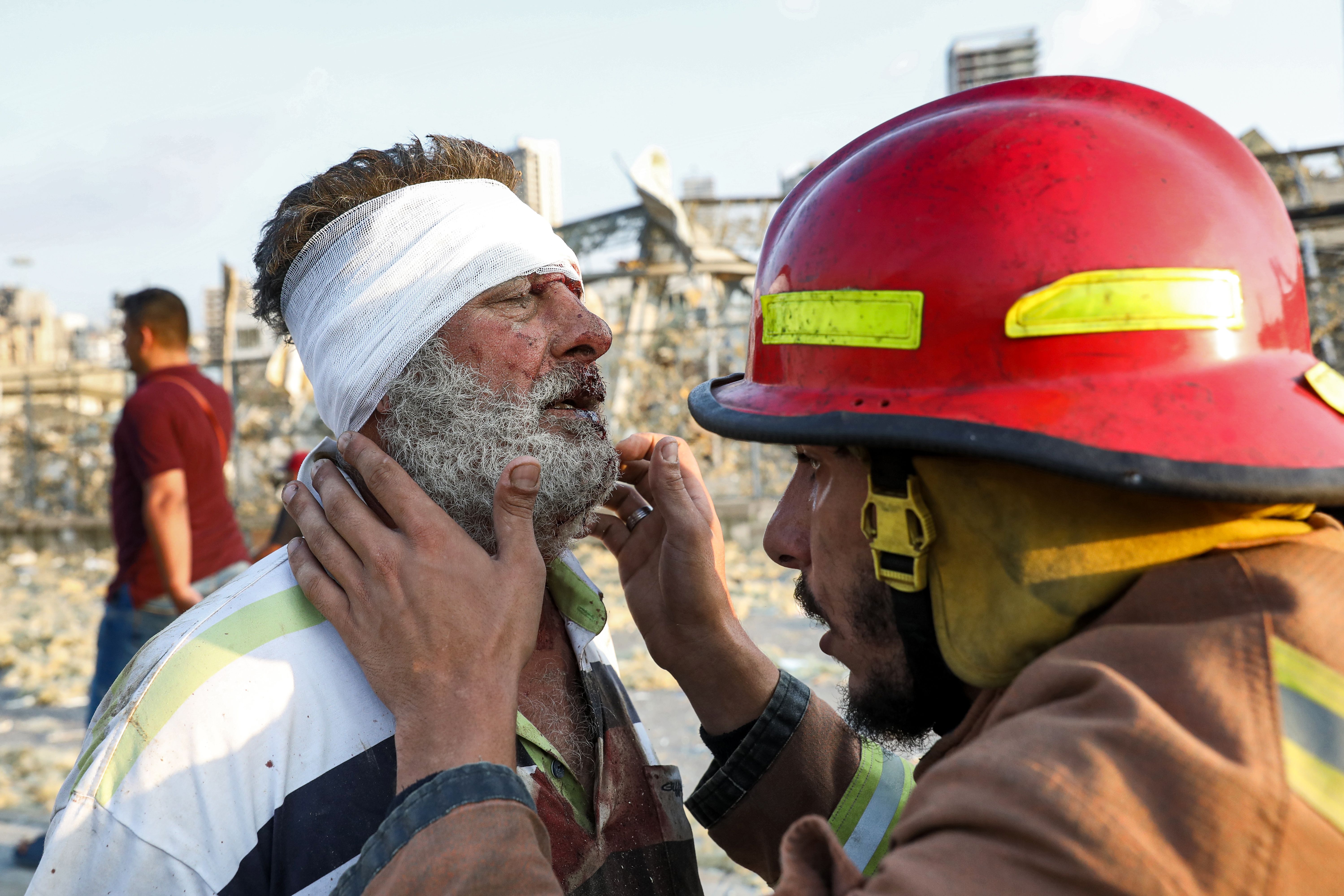 A wounded man is checked by a fireman near the scene of an explosion in Beirut on August 4, 2020. - A large explosion rocked the Lebanese capital Beirut on August 4, an AFP correspondent said. The blast, which rattled entire buildings and broke glass, was felt in several parts of the city. (Photo by Anwar AMRO / AFP) (Photo by ANWAR AMRO/AFP via Getty Images)