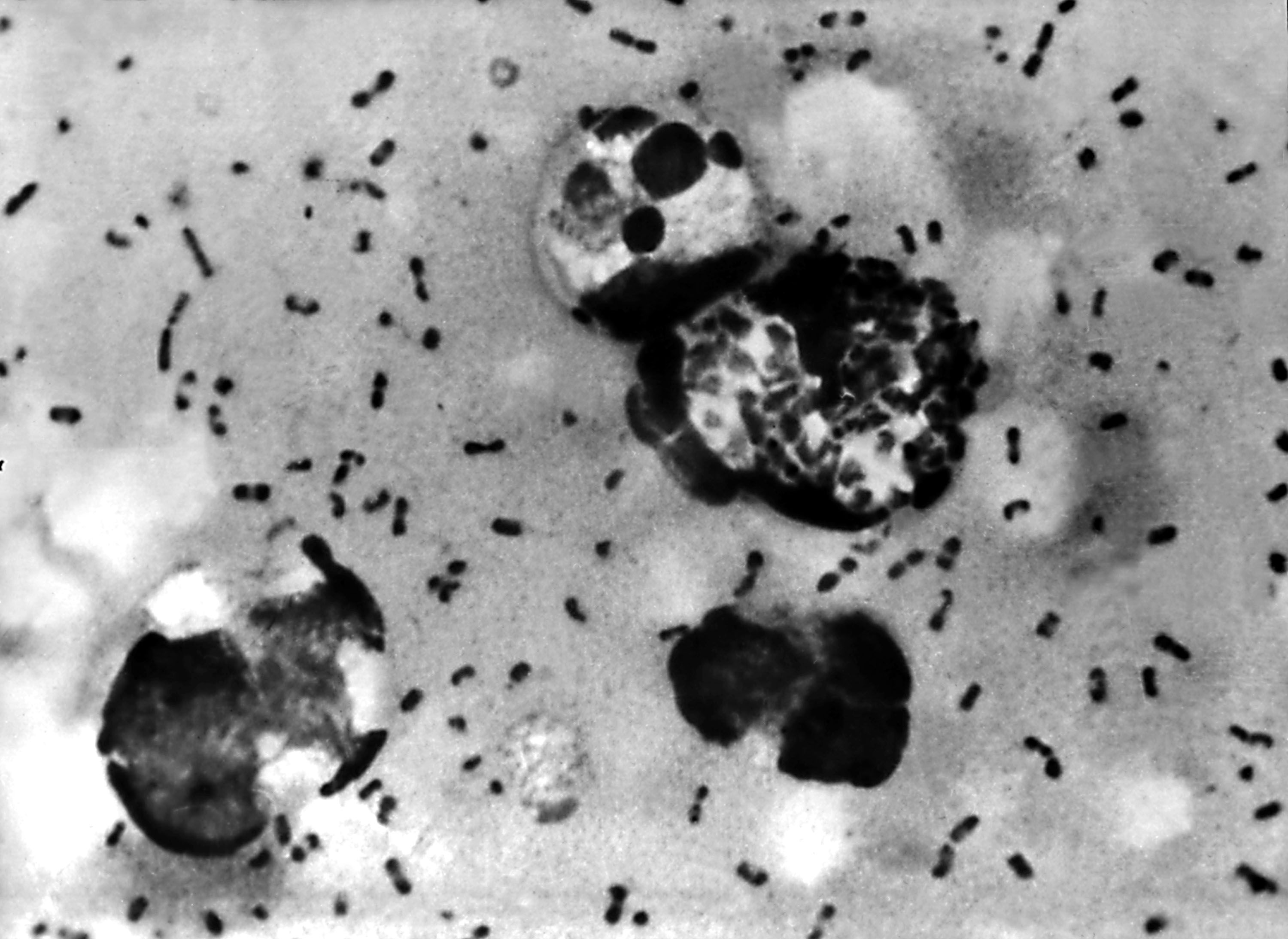 A bubonic plague smear, prepared from a lymph removed from an adenopathic lymph node, or bubo, of a plague patient, demonstrates the presence of the Yersinia pestis bacteria that causes the plague in this undated photo. (Photo by Centers for Disease Control and Prevention/Getty Images)