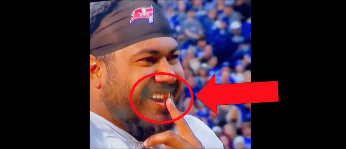 Bucs' Vita Vea loses tooth, mouth bloodied in win vs. Colts