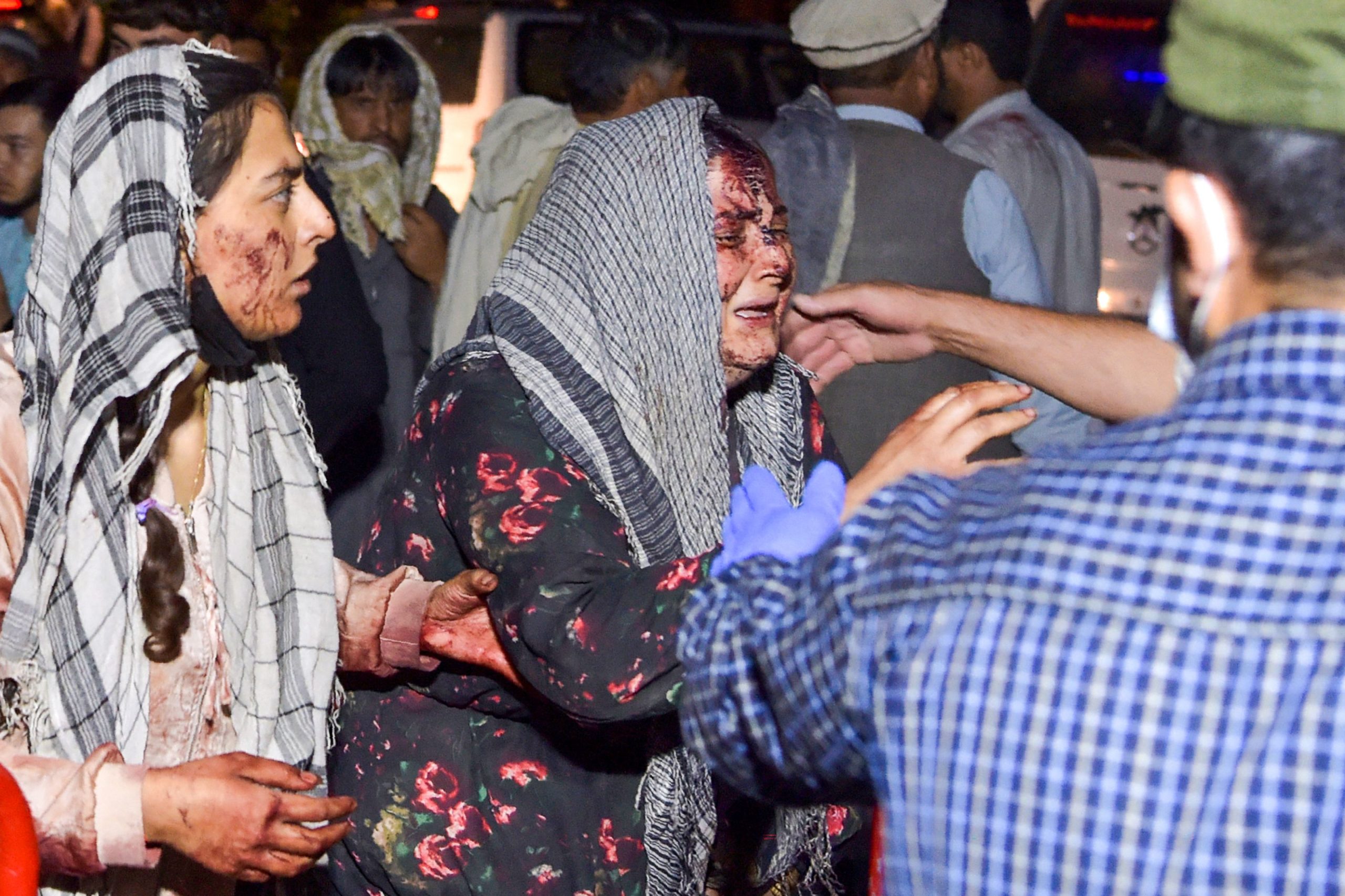EDITORS NOTE: Graphic content / TOPSHOT - Wounded women arrive at a hospital for treatment after two blasts, which killed at least five and wounded a dozen, outside the airport in Kabul on August 26, 2021. (Photo by Wakil KOHSAR / AFP) (Photo by WAKIL KOHSAR/AFP via Getty Images)