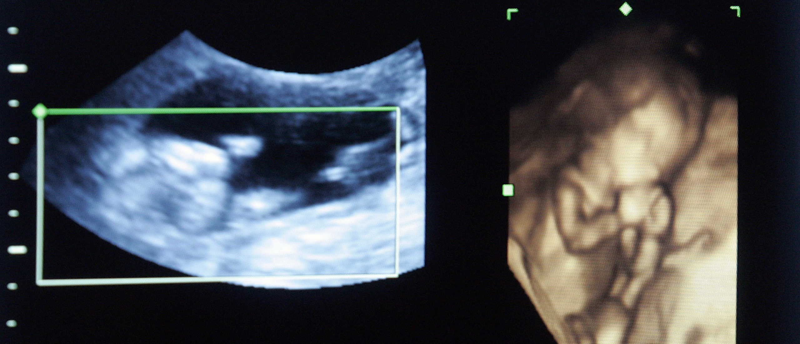 Médicos pro-vida desacreditan mitos comunes sobre el aborto y la salud de la mujer