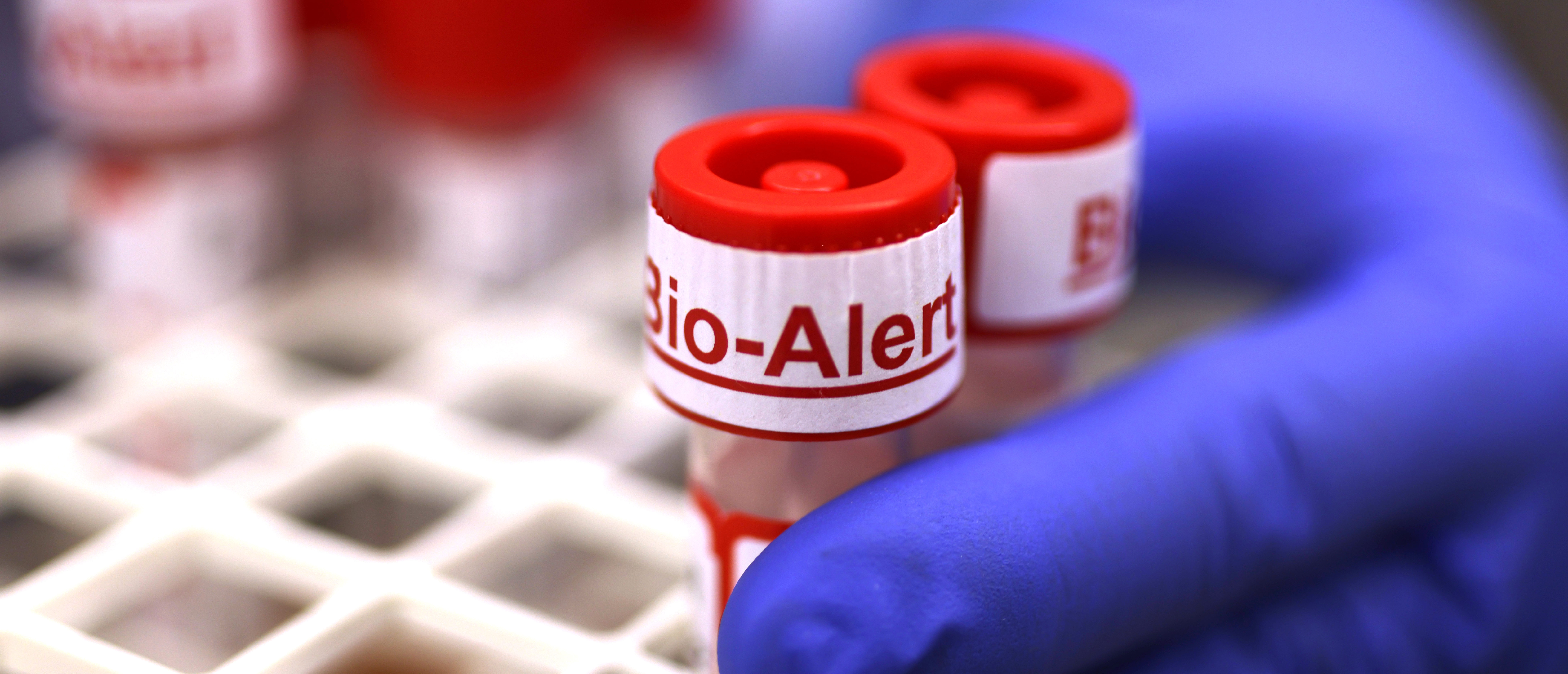 The top of a swab specimen containing Monkeypox virus is labeled "Bio Alert at the UW Medicine Virology Laboratory on July 12, 2022 in Seattle, Washington. (Photo by Karen Ducey/Getty Images)