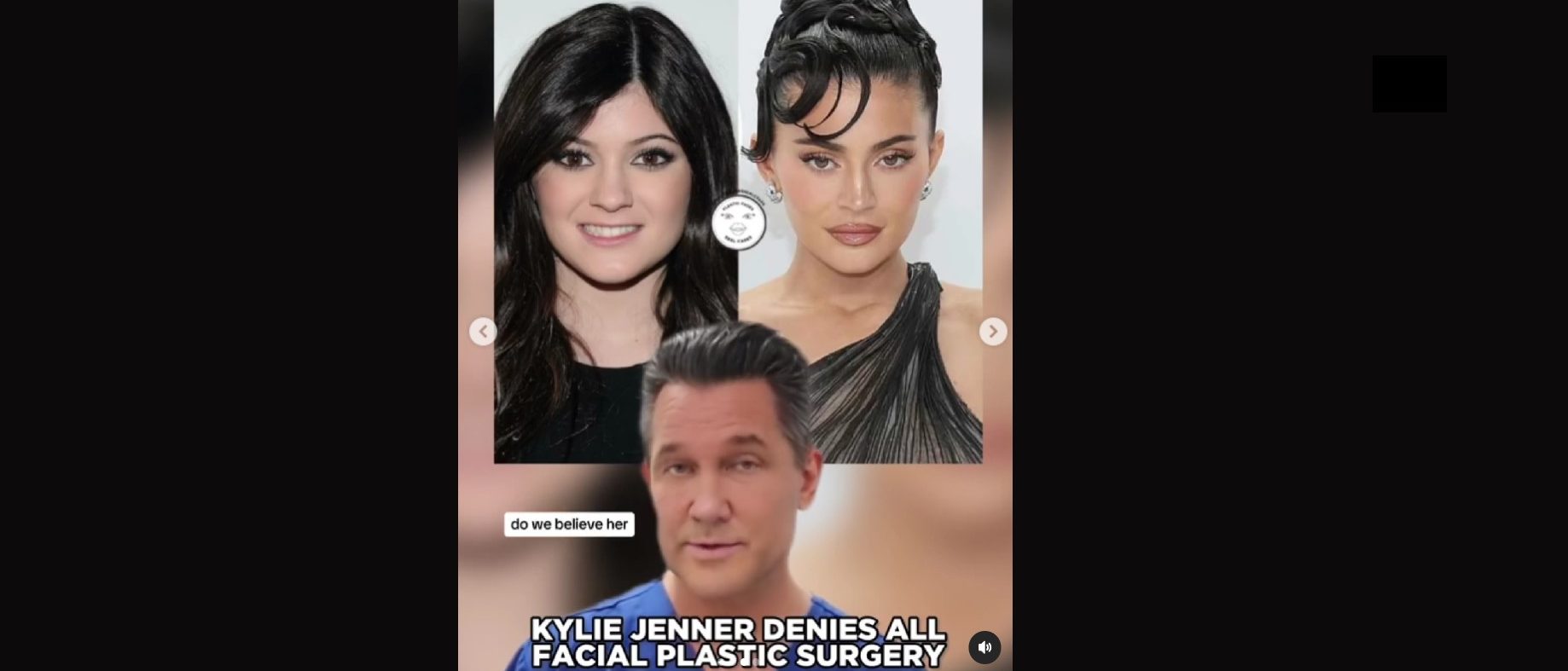 Plastic Surgeon Breaks Down Kylie Jenner ‘morphing Into Radically Different Looking Person 