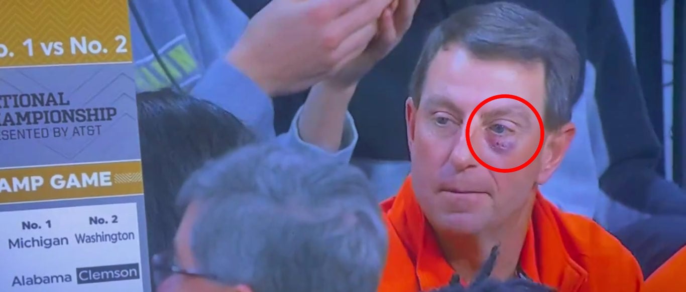 Woah, What Happened? Dabo Swinney Shows Up To UNC-Clemson Basketball Game With Massive Black Eye