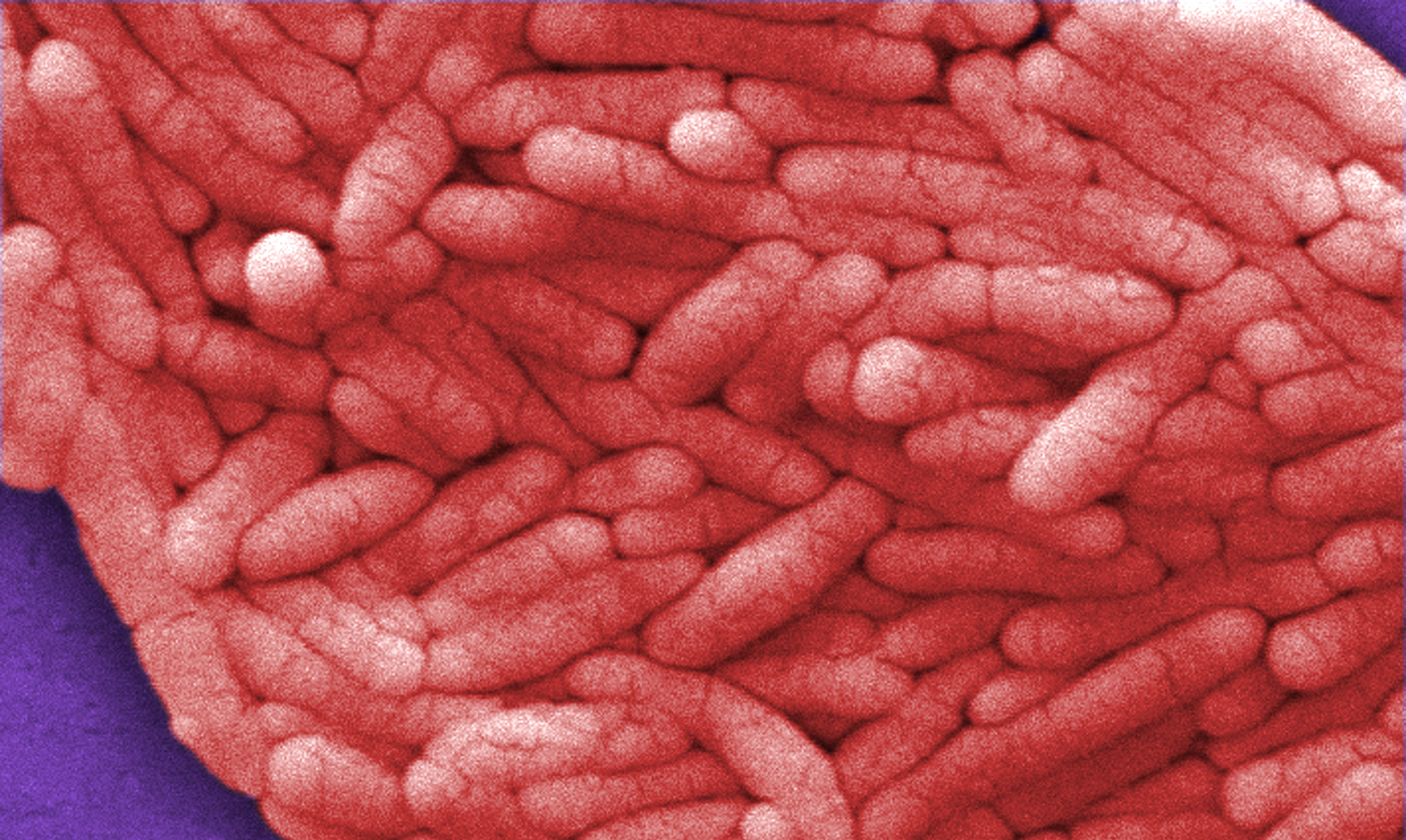 Under a very high magnification of 12000X, this colorized scanning electron micrograph shows a large grouping of Gram-negative Salmonella bacteria. REUTERS/Janice Haney Carr/CDC/Handout (UNITED STATES HEALTH)